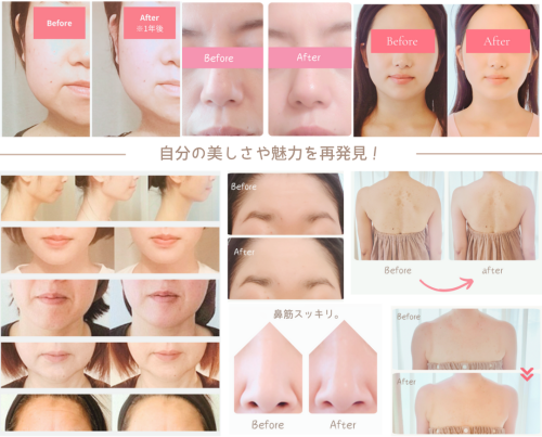 ビフォーアフター (CO).png