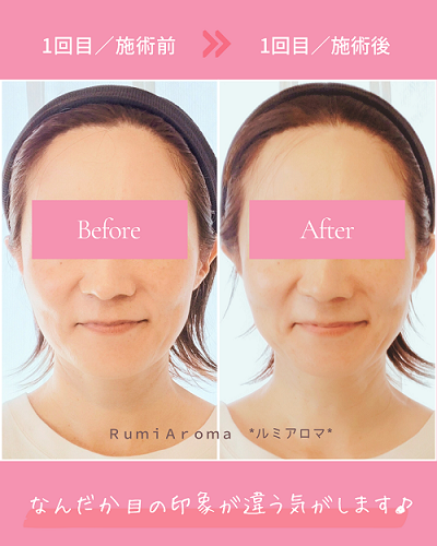 ビフォーアフター（1回目）.png