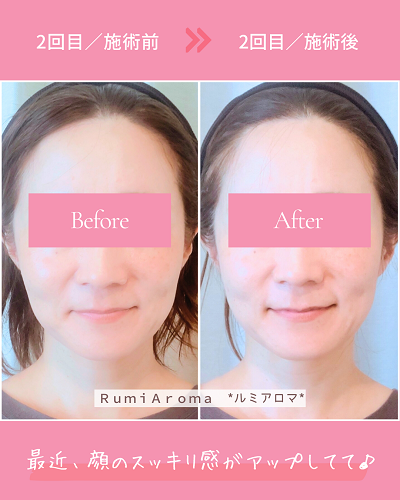 ビフォーアフター（2回目）.png