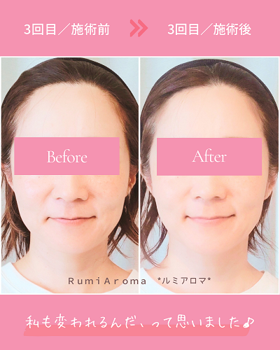 ビフォーアフタ（3回目）.png