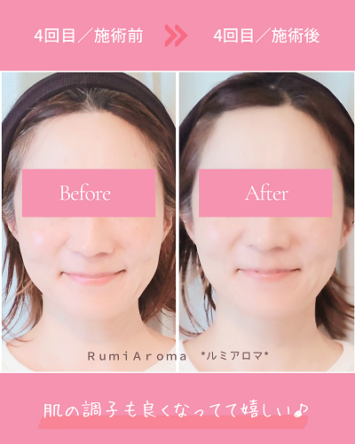 ビフォーアフター（4回目）.png