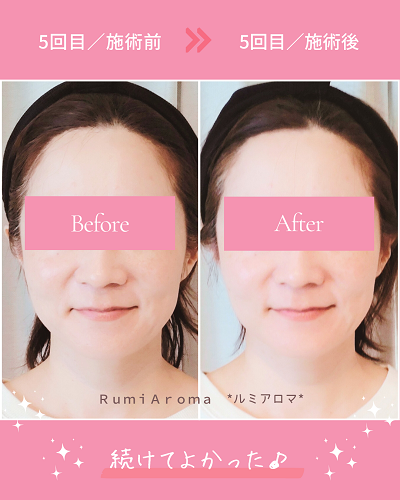 ビフォーアフター（5回目）png.png