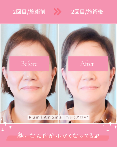 ビフォーアフター(2回目の変化).png