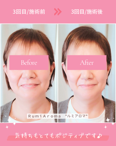 ビフォーアフター(3回目).png