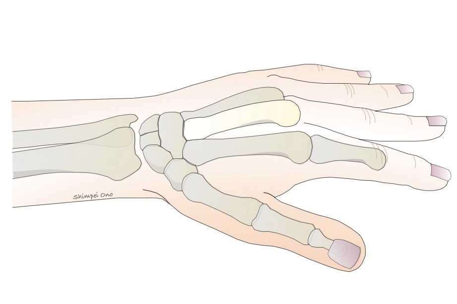 手の輪郭と骨