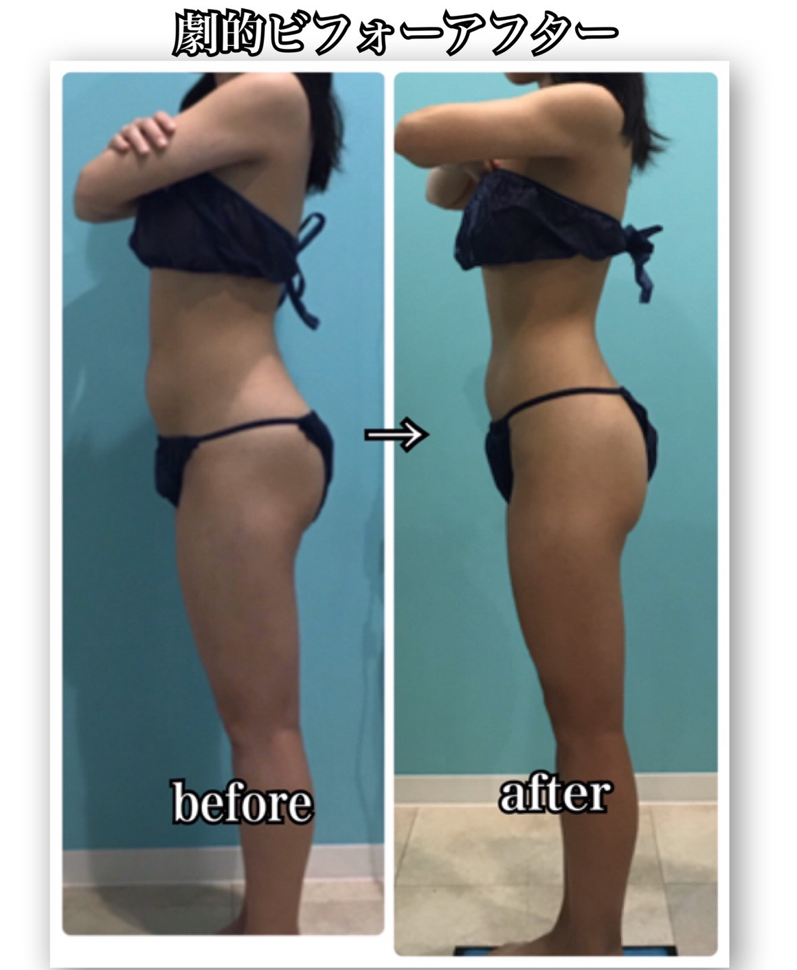 mi♡！【動作確認済】 セルスイーパー　ホームエステ　エンダモロジー　セル スーパーセルムRF+ | ボディケア | 伊藤超短波 エステ関係者向けサイト