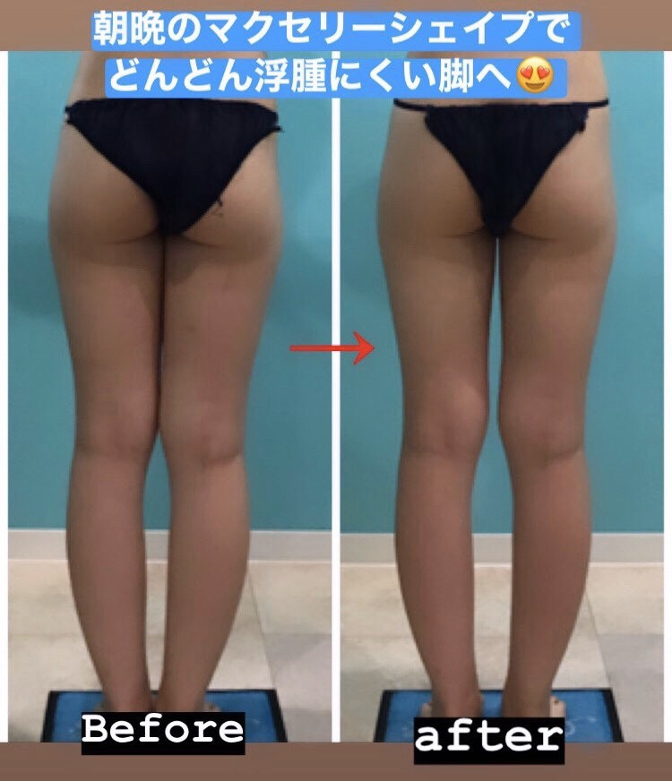 インフォメーション > 2020-08 > 2ページ - エステティックサ