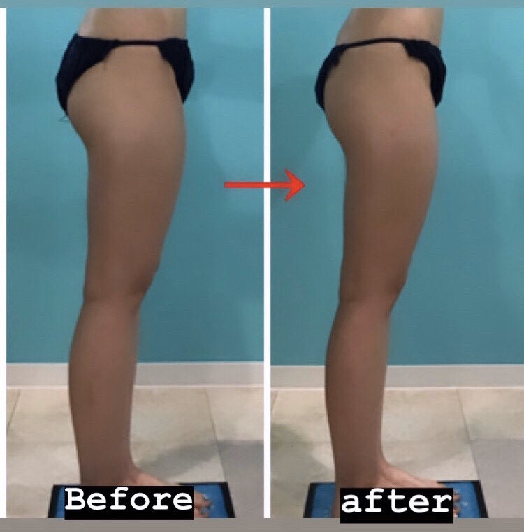 mi♡！【動作確認済】 セルスイーパー　ホームエステ　エンダモロジー　セル エンダモロジー セルM6アライアンス（本体） | 業務用美容・エステ機器