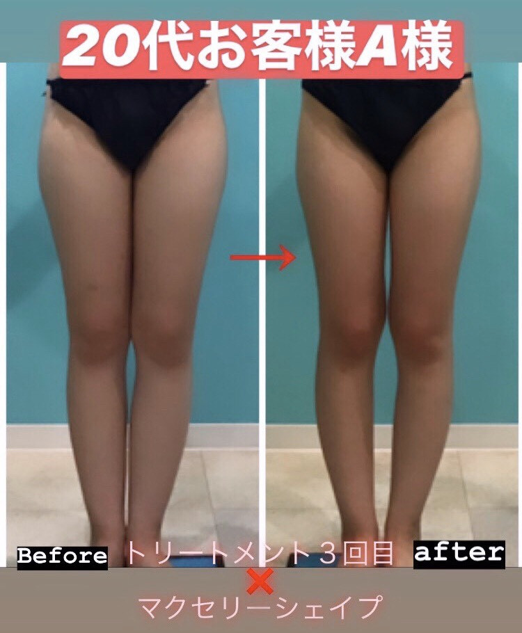 mi♡！【動作確認済】 セルスイーパー　ホームエステ　エンダモロジー　セル エンダモロジー セルM6アライアンス（本体） | 業務用美容・エステ機器