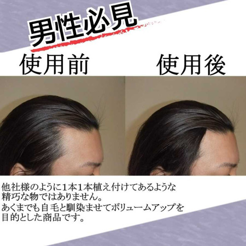 M字用チュールキュア（Lサイズ（約2.5ｃｍ幅）ブラック色）驚異の36束入り＋低刺激かつら用専用シール40個(予備含む) M字型の薄毛部分をカバーしてボリュームUP！  - 円形脱毛症隠すharu-haru 円形脱毛ここまで隠せてこの安さ 円形脱毛症隠し・隠し方ならチュールキュア ...