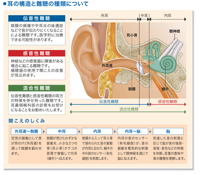 難聴には３種類あります！